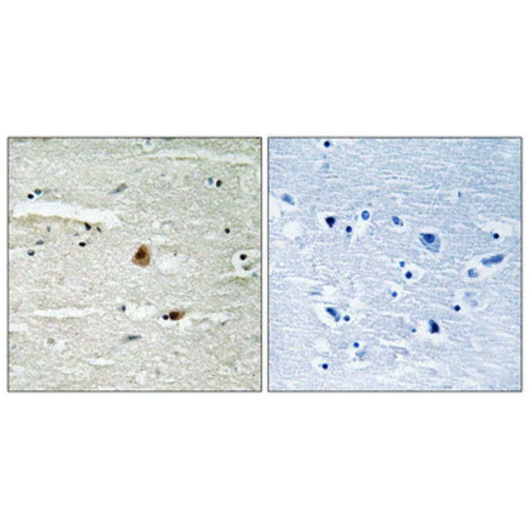 Immunohistochemistry - Anti-COPS1 Antibody (B8322) - Antibodies.com