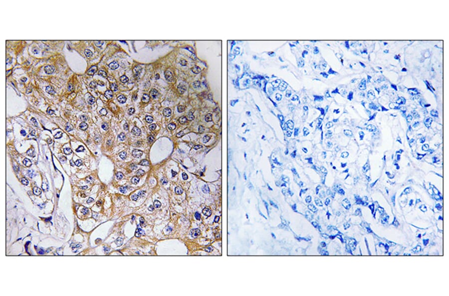 Immunohistochemistry - Anti-CCT6A Antibody (C19088) - Antibodies.com