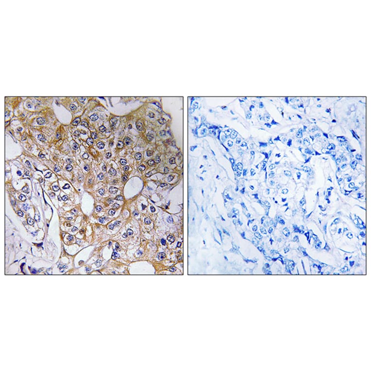 Immunohistochemistry - Anti-CCT6A Antibody (C19088) - Antibodies.com