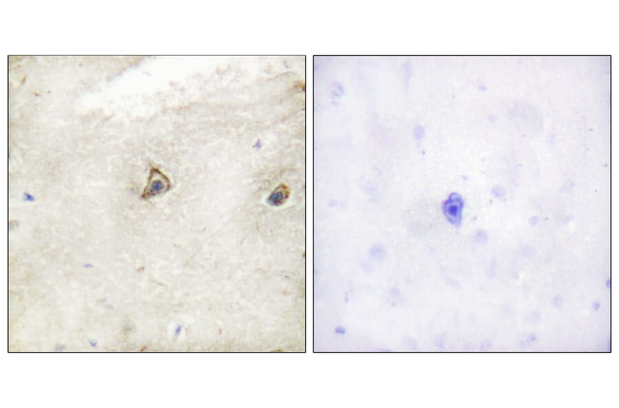 Immunohistochemistry - Anti-c-Abl Antibody (B0624) - Antibodies.com