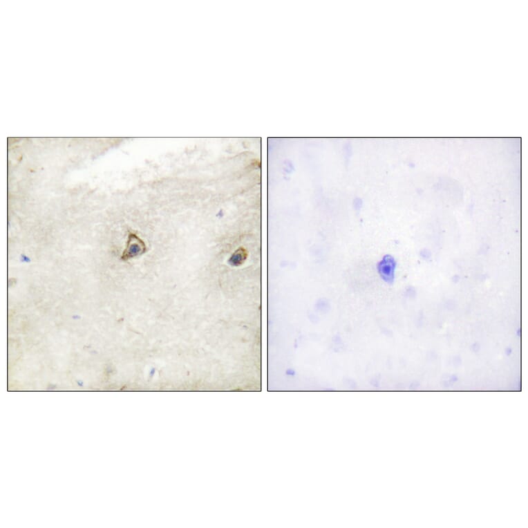 Immunohistochemistry - Anti-c-Abl Antibody (B0624) - Antibodies.com