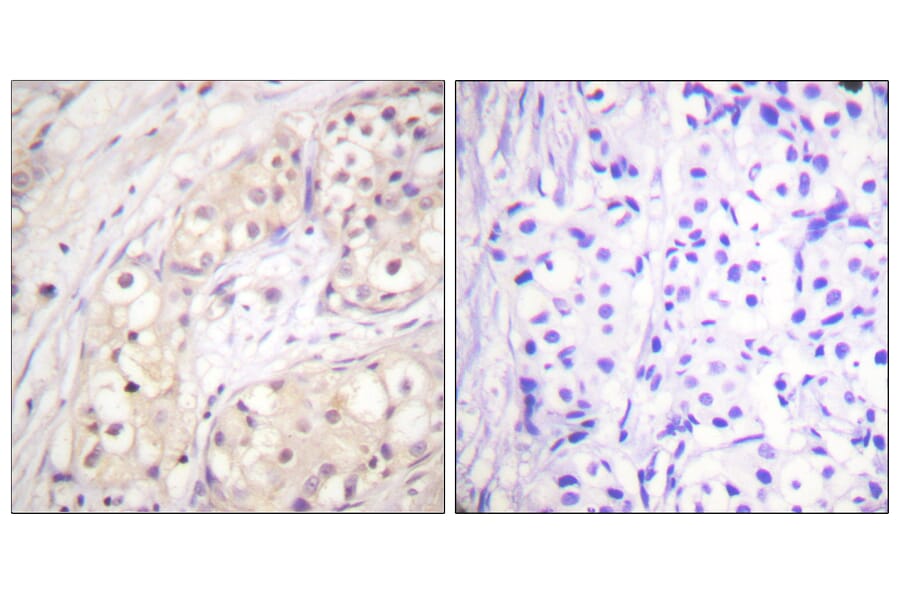 Immunohistochemistry - Anti-B-RAF Antibody (B0780) - Antibodies.com