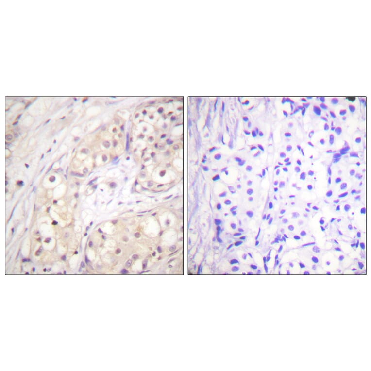 Immunohistochemistry - Anti-B-RAF Antibody (B0780) - Antibodies.com