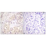 Immunohistochemistry - Anti-B-RAF Antibody (B0780) - Antibodies.com
