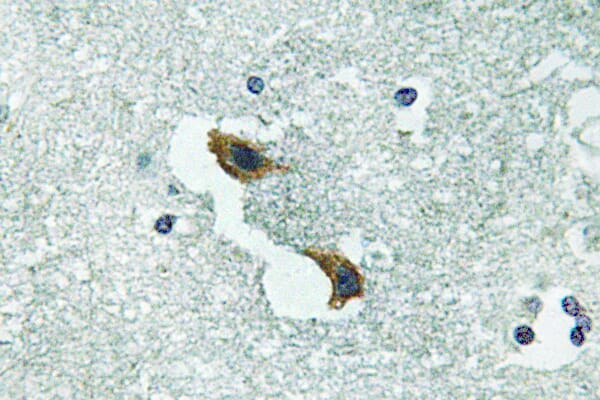 Anti-ATP7A (H640) Antibody (A27107) | Antibodies.com