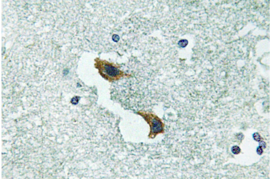 Immunohistochemistry - Anti-ATP7A Antibody (R12-2033) - Antibodies.com