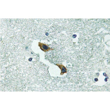 Immunohistochemistry - Anti-ATP7A Antibody (R12-2033) - Antibodies.com