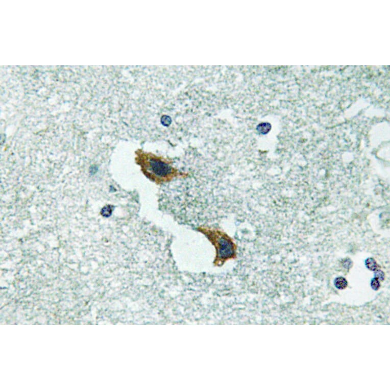 Immunohistochemistry - Anti-ATP7A Antibody (R12-2033) - Antibodies.com