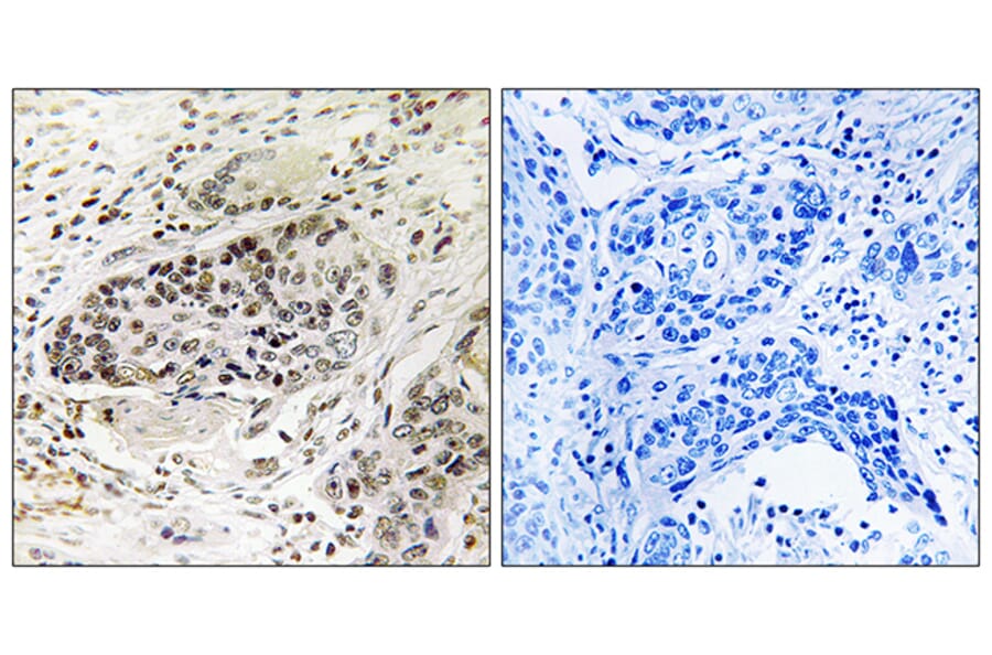 Immunohistochemistry - Anti-APBA2 Antibody (C14449) - Antibodies.com