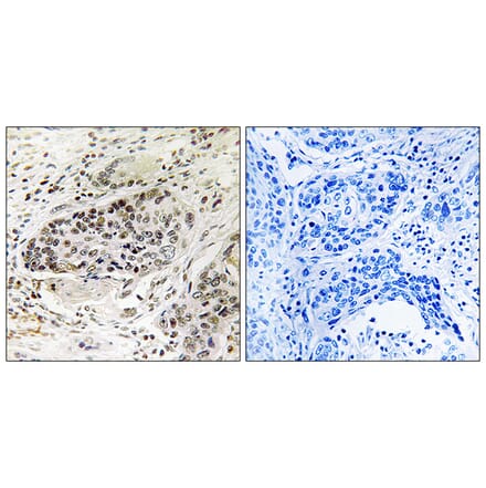 Immunohistochemistry - Anti-APBA2 Antibody (C14449) - Antibodies.com