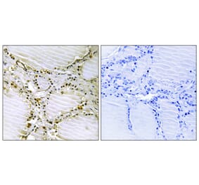 Immunohistochemistry - Anti-AMPD1 Antibody (C14443) - Antibodies.com