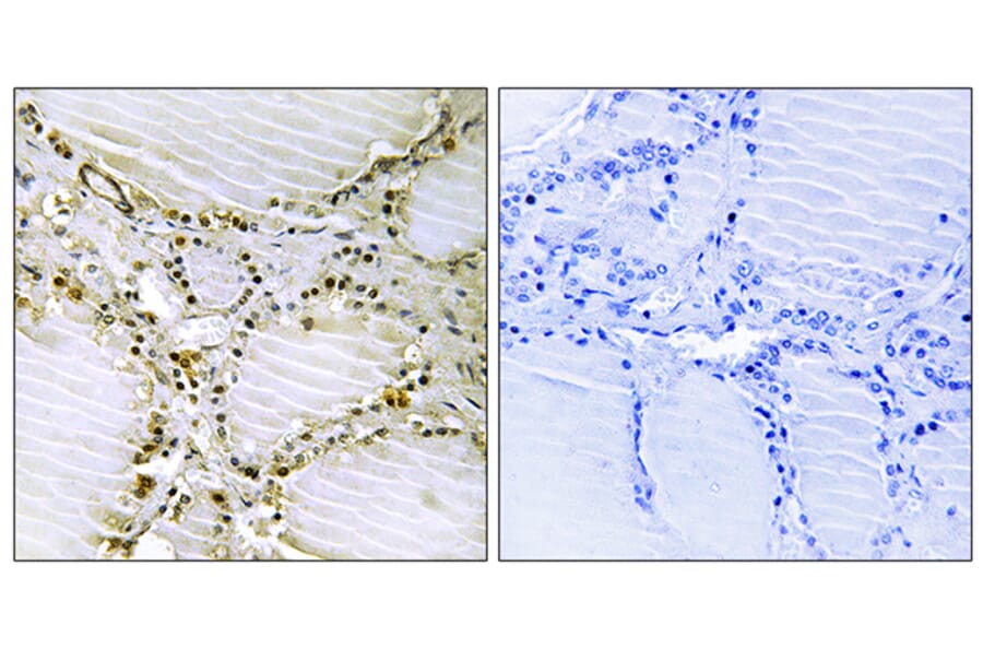 Immunohistochemistry - Anti-AMPD1 Antibody (C14443) - Antibodies.com