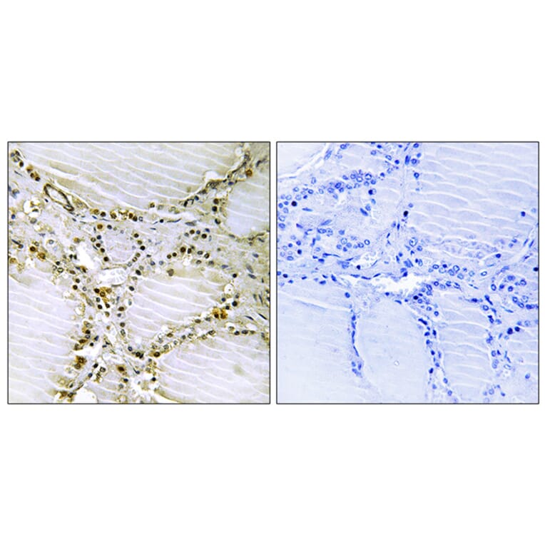 Immunohistochemistry - Anti-AMPD1 Antibody (C14443) - Antibodies.com