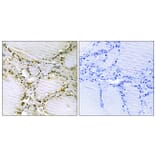 Immunohistochemistry - Anti-AMPD1 Antibody (C14443) - Antibodies.com