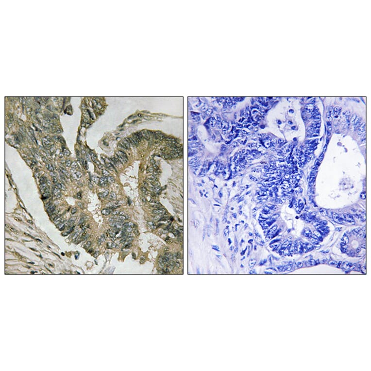 Immunohistochemistry - Anti-ALDOC Antibody (C15823) - Antibodies.com