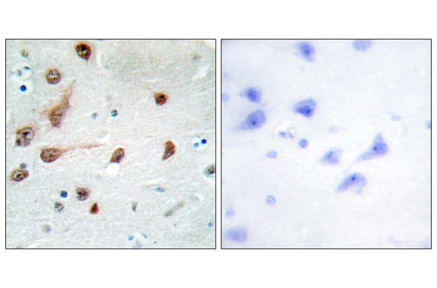 Immunohistochemistry - Anti-ADAR1 Antibody (C10740) - Antibodies.com