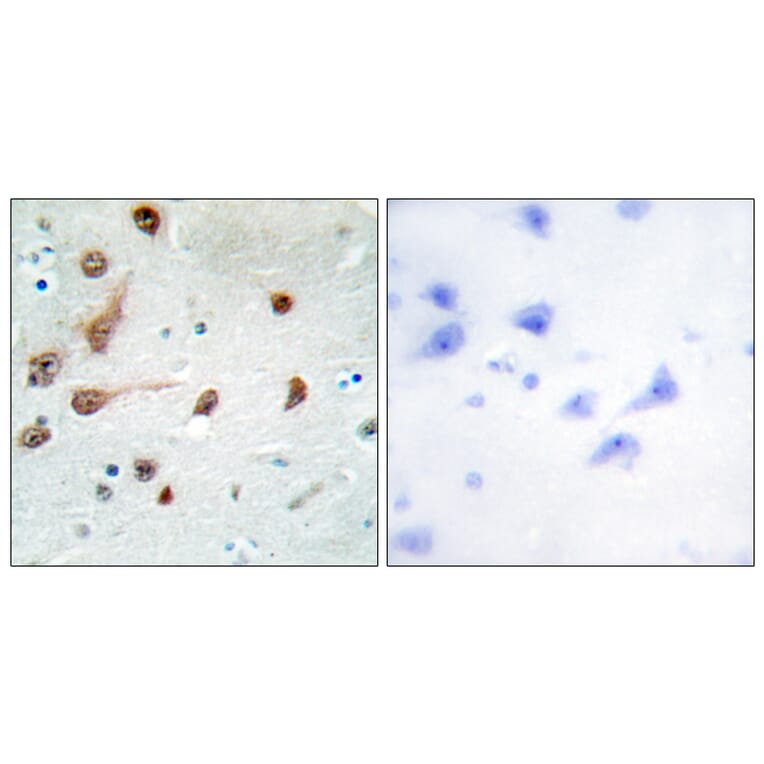 Immunohistochemistry - Anti-ADAR1 Antibody (C10740) - Antibodies.com