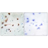 Immunohistochemistry - Anti-ADAR1 Antibody (C10740) - Antibodies.com