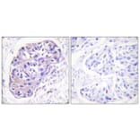 Immunohistochemistry - Anti-GRK2 Antibody (B0486) - Antibodies.com