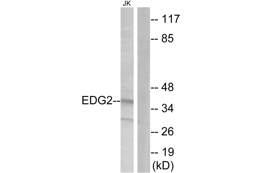 Western Blot - Anti-EDG2 Antibody (G083) - Antibodies.com