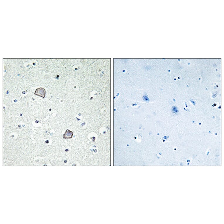Immunohistochemistry - Anti-EDG2 Antibody (G083) - Antibodies.com