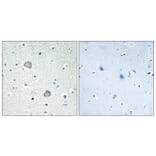 Immunohistochemistry - Anti-EDG2 Antibody (G083) - Antibodies.com