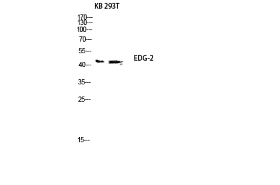 Western Blot - Anti-EDG2 Antibody (G083) - Antibodies.com