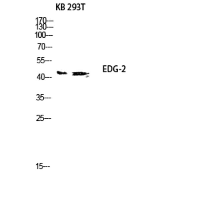 Western Blot - Anti-EDG2 Antibody (G083) - Antibodies.com