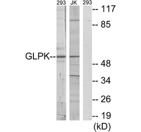 Western Blot - Anti-GK Antibody (C10533) - Antibodies.com