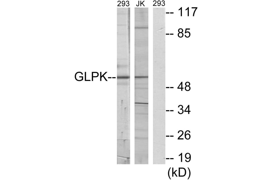 Western Blot - Anti-GK Antibody (C10533) - Antibodies.com