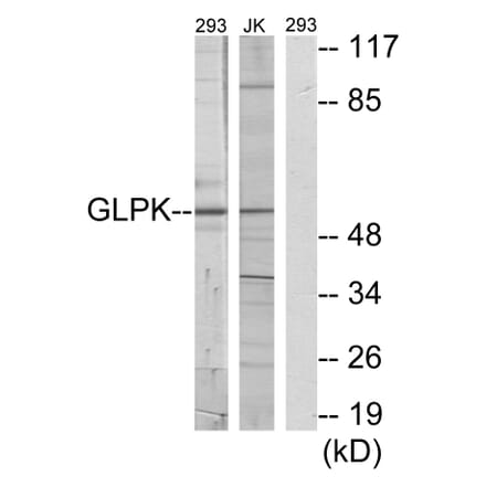 Western Blot - Anti-GK Antibody (C10533) - Antibodies.com