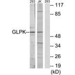 Western Blot - Anti-GK Antibody (C10533) - Antibodies.com