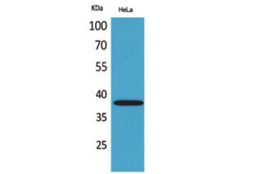 Western Blot - Anti-KIR2DL3 + KIR2DS2 Antibody (C30568) - Antibodies.com