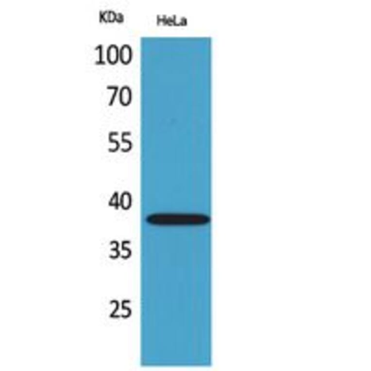 Western Blot - Anti-KIR2DL3 + KIR2DS2 Antibody (C30568) - Antibodies.com