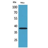 Western Blot - Anti-KIR2DL3 + KIR2DS2 Antibody (C30568) - Antibodies.com