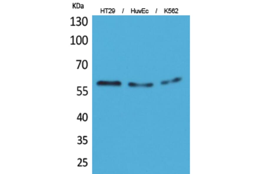Western Blot - Anti-CYP11B1 + CYP11B2 Antibody (C30264) - Antibodies.com