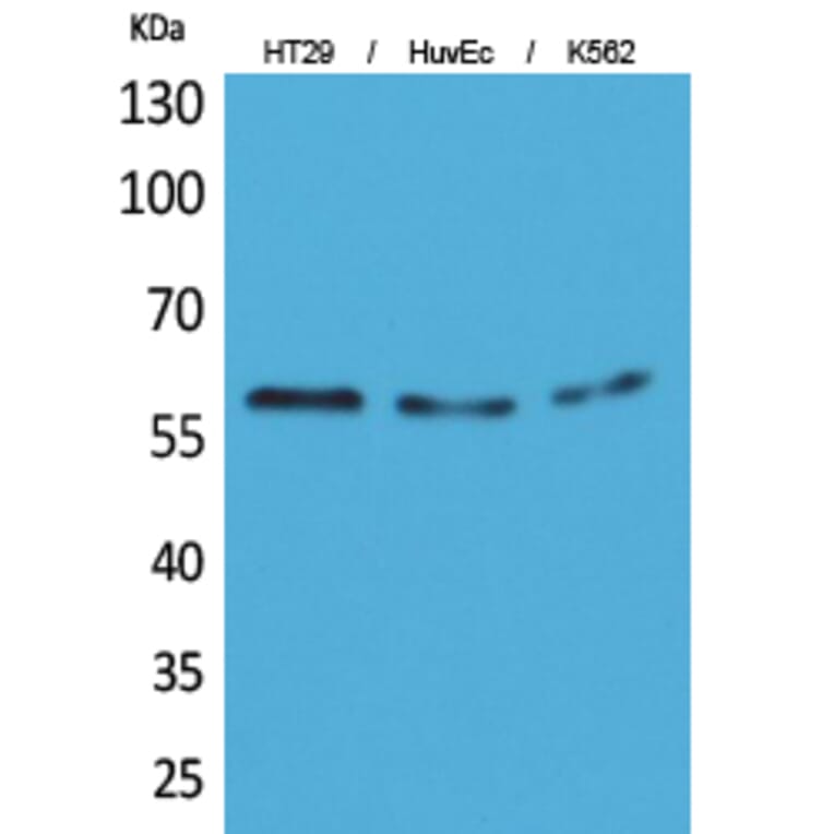 Western Blot - Anti-CYP11B1 + CYP11B2 Antibody (C30264) - Antibodies.com