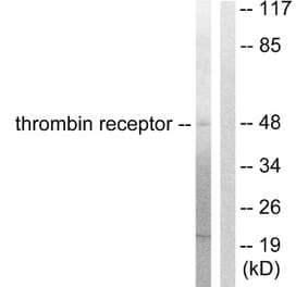 Western Blot - Anti-Thrombin Receptor Antibody (C0344) - Antibodies.com