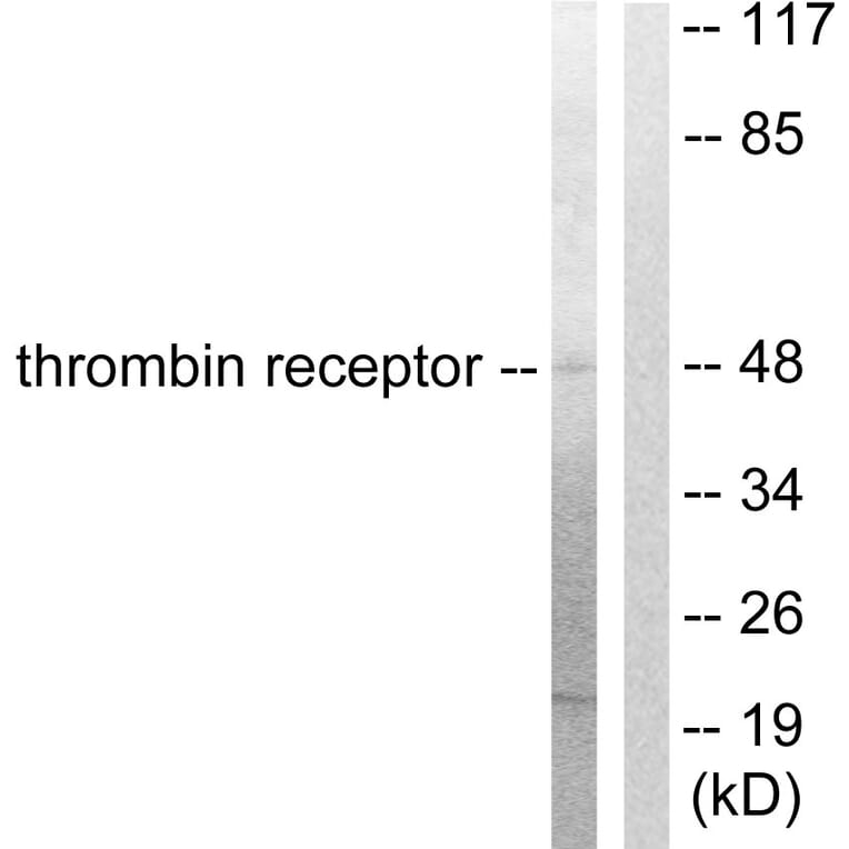 Western Blot - Anti-Thrombin Receptor Antibody (C0344) - Antibodies.com