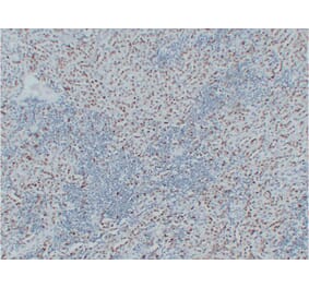 Immunohistochemistry - Anti-Wilms' Tumor 1 Antibody (V0140) - Antibodies.com