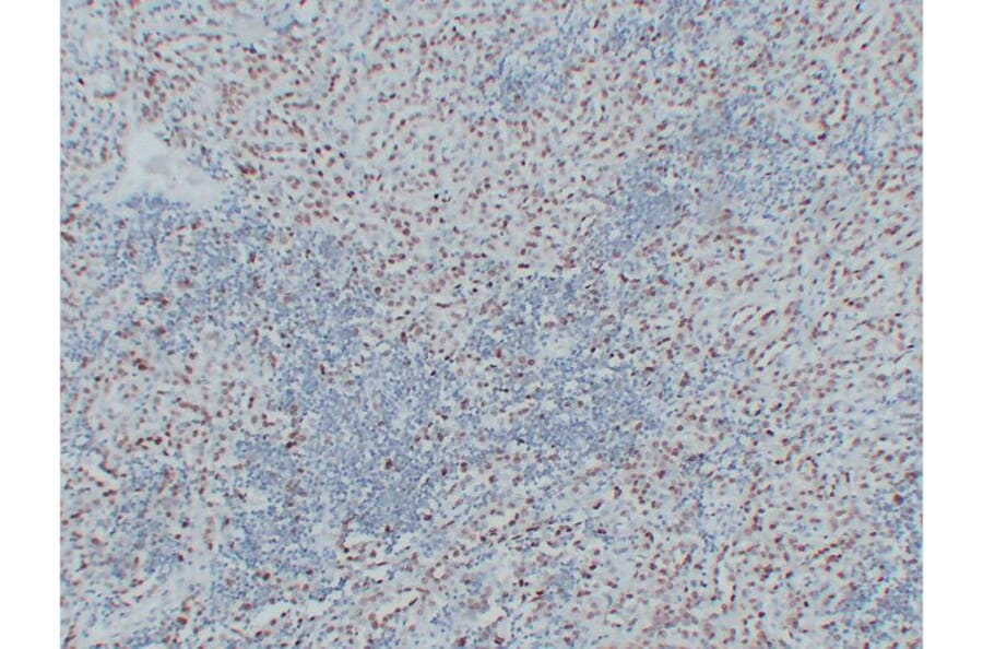 Immunohistochemistry - Anti-Wilms' Tumor 1 Antibody (V0140) - Antibodies.com