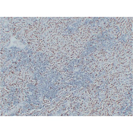 Immunohistochemistry - Anti-Wilms' Tumor 1 Antibody (V0140) - Antibodies.com