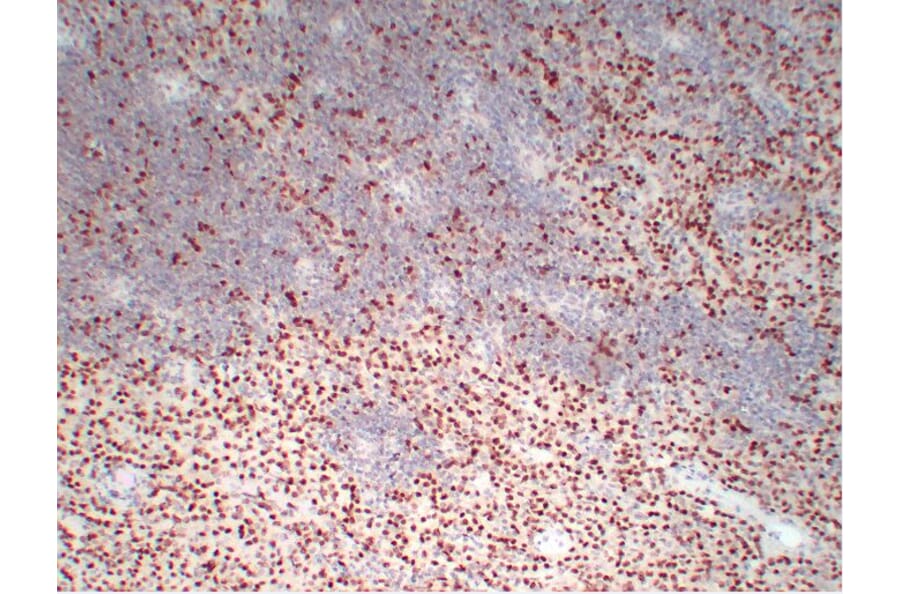 Immunohistochemistry - Anti-Wilms' Tumor 1 Antibody (V0140) - Antibodies.com