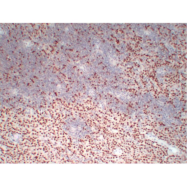 Immunohistochemistry - Anti-Wilms' Tumor 1 Antibody (V0140) - Antibodies.com