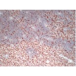Immunohistochemistry - Anti-Wilms' Tumor 1 Antibody (V0140) - Antibodies.com