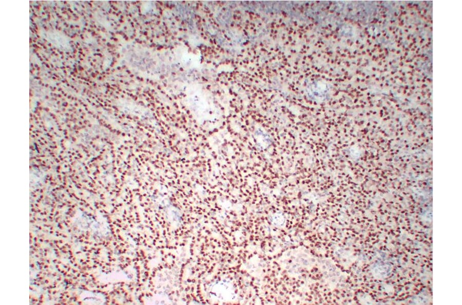 Immunohistochemistry - Anti-Wilms' Tumor 1 Antibody (V0140) - Antibodies.com