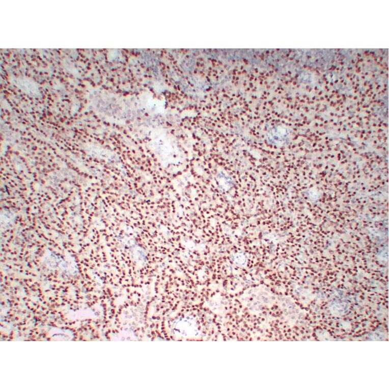 Immunohistochemistry - Anti-Wilms' Tumor 1 Antibody (V0140) - Antibodies.com
