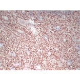 Immunohistochemistry - Anti-Wilms' Tumor 1 Antibody (V0140) - Antibodies.com
