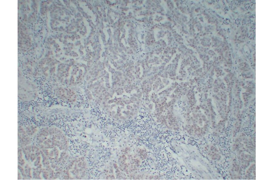 Immunohistochemistry - Anti-Wilms' Tumor 1 Antibody (V0140) - Antibodies.com