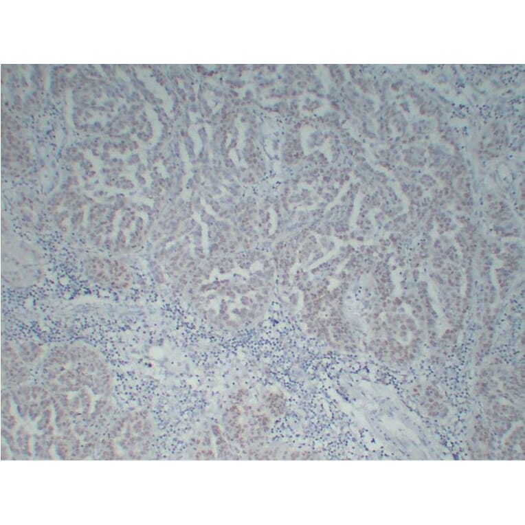 Immunohistochemistry - Anti-Wilms' Tumor 1 Antibody (V0140) - Antibodies.com